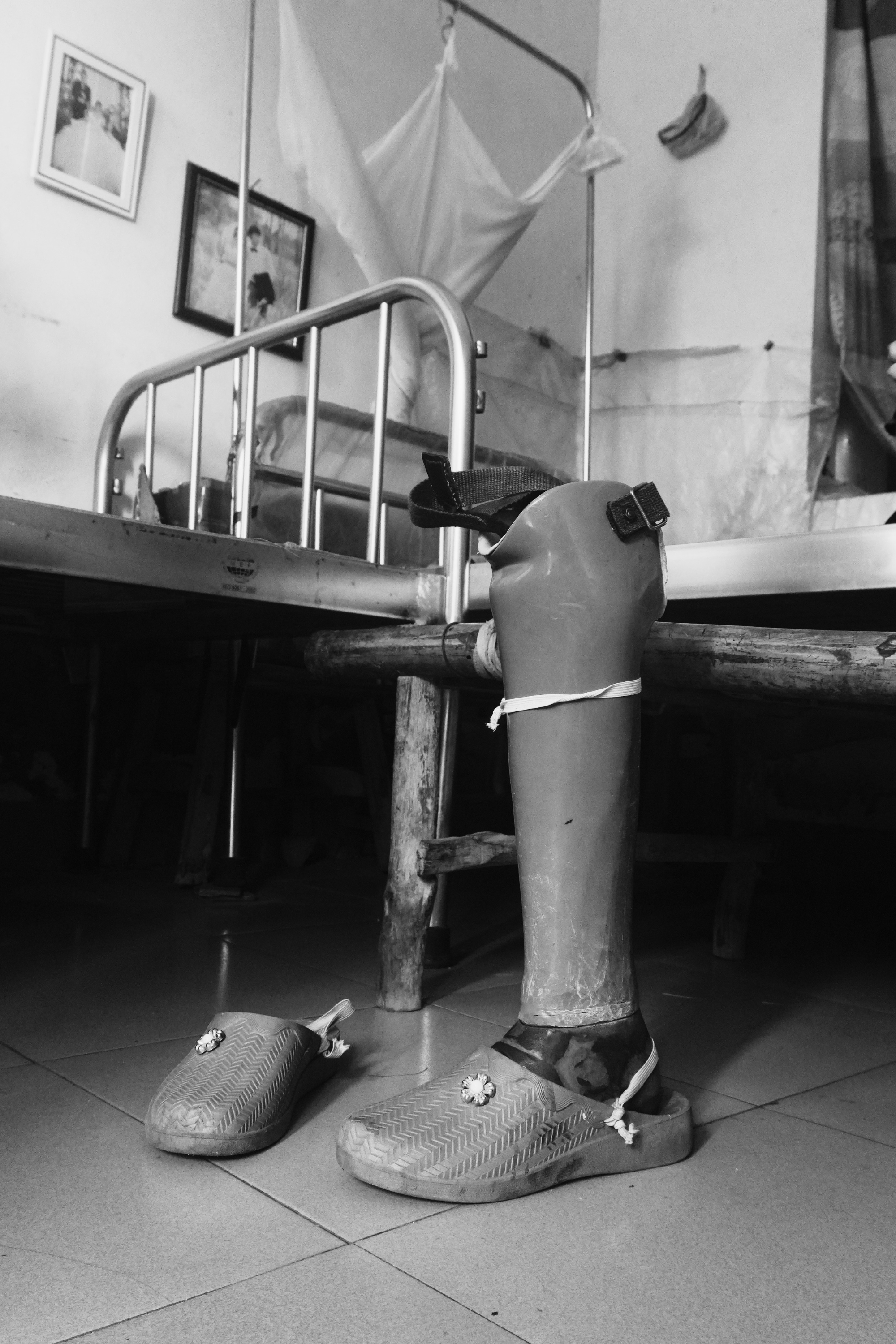 Một chiếc chân giả của bệnh nhân
